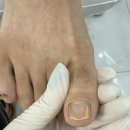 메디타워 | 군포발톱무좀 풋케어샵 방문 후기 풋네일 동성제약 풀리메디 군포산본점