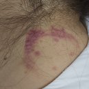 헬스트론 | 혈행개선~ 헬스트론 내돈내산 후기