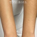 리즈피부샵