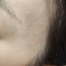 족동천 | 대구 칠곡 피부관리실 렛미인 에스테틱에서 바이오리필로 피부 리셋했어요!