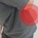 계수나무한의원 네이버블로그
