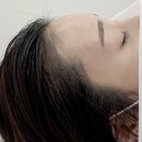 리나헤어라인