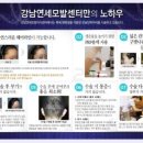 연세헤어성형외과의원 네이버블로그