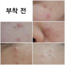 구리동물약국 | <메가돔약국> 더마틱스 리페어 스팟패치 2종 사용 후기