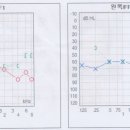 삼성히어링에이드