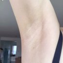 홈케어웰빙약국 | 겨드랑이 색소침착 약국 연고 착색 크림 후기 (내돈내산)