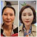 ［대전 인셀덤 라온점］선화동 피부관리샵에서 피부관리 받은 후기