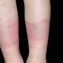 하범석피부과의원 이미지