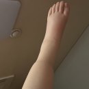 고혈압의 합병증 | 임신중독증 유도분만 출산 후기｜38주 고혈압·단백뇨 증상