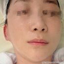 라라약국 | 쌍문역피부관리 잘하는 라라뷰티샵 촉촉한 물광 피부 솔직 후기