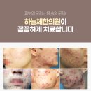 참진한방병원 네이버블로그