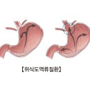 위 이미지