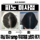 더벤티(미사그랑파사쥬점) | 하남SMP 가르마 두피 채움 3회차 두피가 빽빽해진 리얼 변화 피노 SMP 미사점 솔직후기