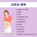 미미반점&산동성 | 초기 만기 선천성 매독 원인 전파경로 증상 비성호흡 허친슨치아