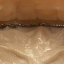 하이교정치과기공소 이미지