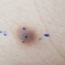 아이앤유 이미지