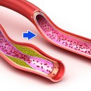 일움한의원 이미지