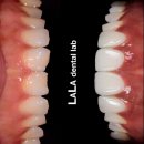 본기공소 이미지