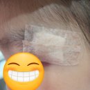 아이 눈썹 밑 찢어진 상처 봉합수술 비용 내 돈 내산 힐링 성형외과 후기