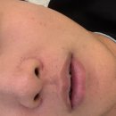 청담스타성형외과의원