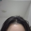 봉곡동103 | [구미 헤드스파, 두피케어 잘 하는 곳: 봉곡동 하루 헤드스파(내돈내산)]