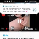 디에이픽스 네이버블로그