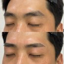 윤정 에스테틱 - 중구 | [공지] 동탄역 페이스왁싱 성지 피아에스테틱/ 남여 눈썹 왁싱 비포애프터