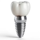 유암타워빌딩 | 시흥시 임플란트 치과 잘하는 곳, 가격 비용 싼 곳 BEST10 추천