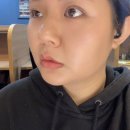 상무병원 | 상무지구피부과 써마지 대신 볼뉴머 600샷+슈링크300샷 볼뉴마이징효과 볼링크 2주 후기