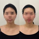 다이아짐(DIA GYM) | 강남 윤곽관리 다이아에스테틱 압구정점 예신관리 안면비대칭 관리