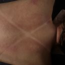 발란스바디메디칼 | 상동피부관리 잘하는 곳 사운드바디 사운드스킨 부천 Avenue 센터 후기