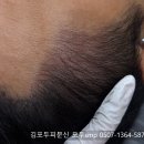 영수헤어라인 | 사냥개들2 비 헤어라인 두피문신일까?