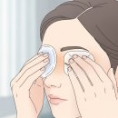 다래끼 빨리 낫는 법, 찜질 순서와 항생제 복용 시기 이미지