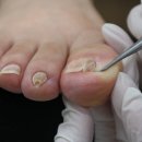 아이캔네일 이미지