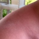 임주영피부과의원 | 10월 둘째 주의 일상 (순천 임주영 피부과 후기)