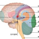 뇌졸증 이미지