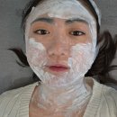 목이짱 | 천안 편평사마귀 성지에서 얼굴&목 편평사마귀 제거 후기 내돈내산