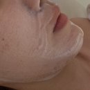 몽프로디 | 신림 여드름 압출 잘하는 곳 | 목까지 번진 좁쌀 자극 없이 케어 잘하는 몽프로디