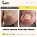 레푸스 망우점