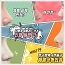 코수술잘하는곳 강남 예롬 추천합니다~
