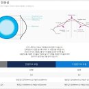 아이줌안경콘텍트 이미지