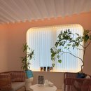 용산-300 | 용산 한남동피부과에서 세르프 리프팅 300샷 받은지 3주 후기