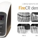 디지레이 | Fire CR dental(스캔 타입 필름형 엑스레이) 체험 후기