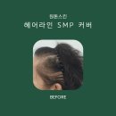 스타헤어라인 네이버블로그