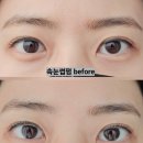 동안뷰티김포 네이버블로그