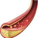 강남탑한의원 이미지