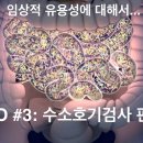 SIBO #3: 수소호기검사 판독법 - 검사 방법과 결과 판독법에 대해서 말씀 드립니다. (유기산검사 vs 수소호기검사) 이미지