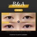 아이컨텍성형외과의원 이미지