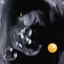 태영21내과의원 | 21주 정밀 초음파 후기｜검사 1시간 걸려도 괜찮을까? 직접 겪은 경험