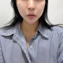 맑은얼굴피부과의원 | 선릉역 피부과 맑은선의원 슈덴하이리프팅 내돈내산 후기